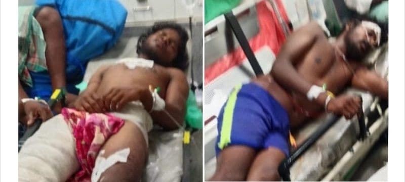 पलामू के सतबरवा में राहुल दुबे गैंग द्वारा फायरिंग में कंस्ट्रक्शन कंपनी के दो मजदूर घायल