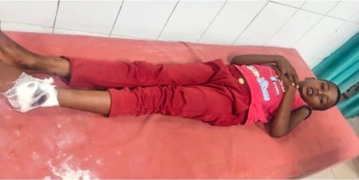 लेनदेन विवाद में चली गोली, 12 वर्षीय बालक घायल, हालत खतरे से बाहर