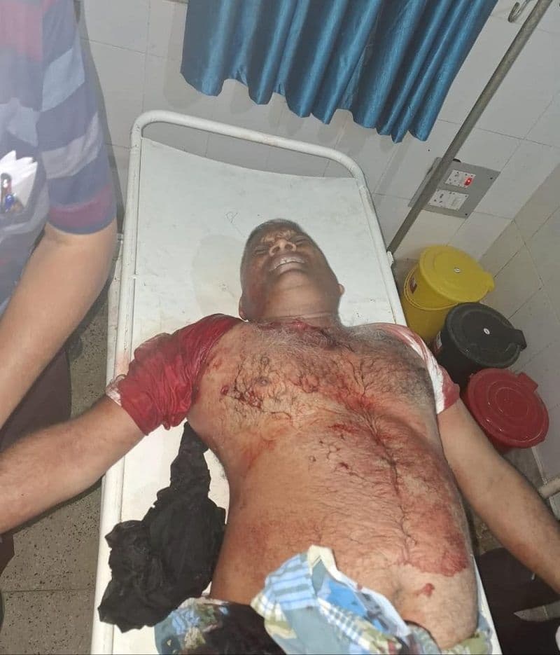थाना क्षेत्र के खजूरी नौडीहा में अज्ञात अपराधियों ने शिक्षक को मारी गोली, गंभीर हालत में रेफर