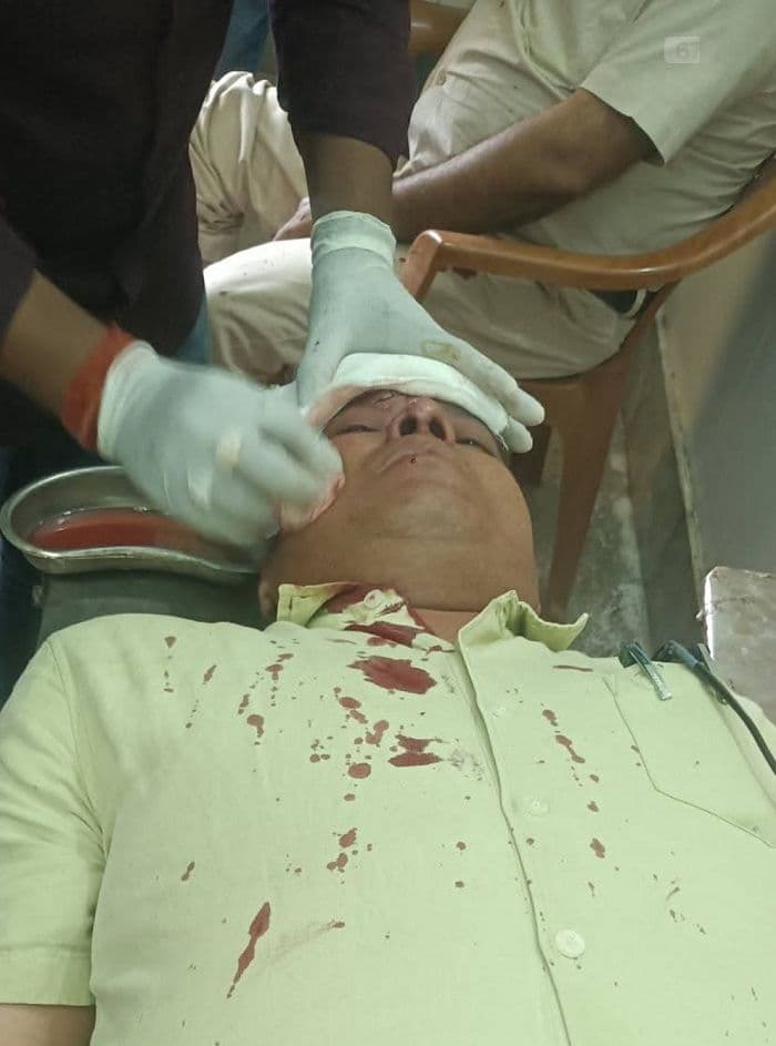 पलामू जिले के नौडीहा बाजार व पीपरा के अंचलाधिकारी सड़क दुर्घटना में घायल, अस्पताल में भर्ती