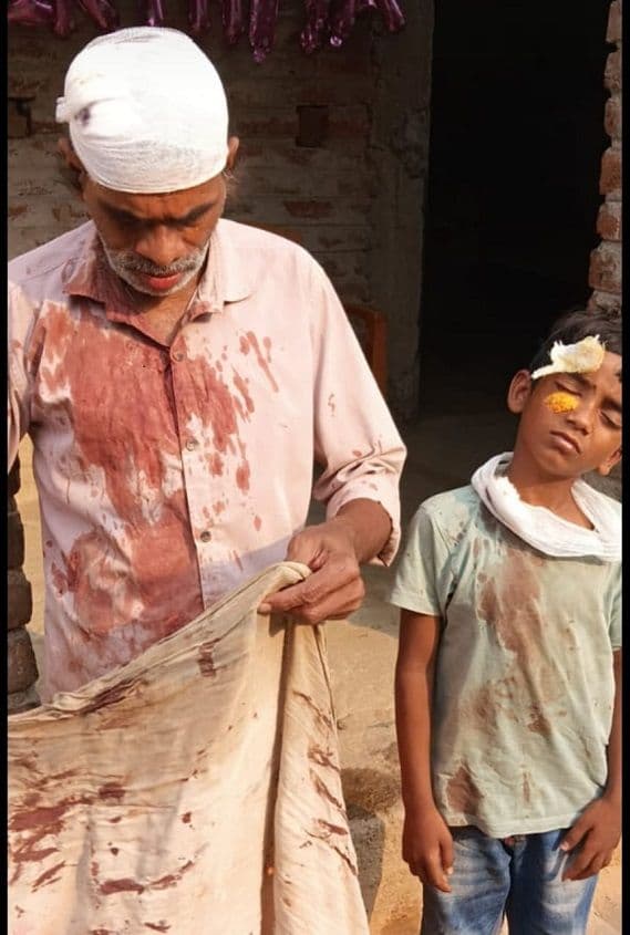 बच्चे के बालू में खेलने के दौरान हुआ विवाद, नाना व नाती को लोहे के रड से मारकर किया घायल