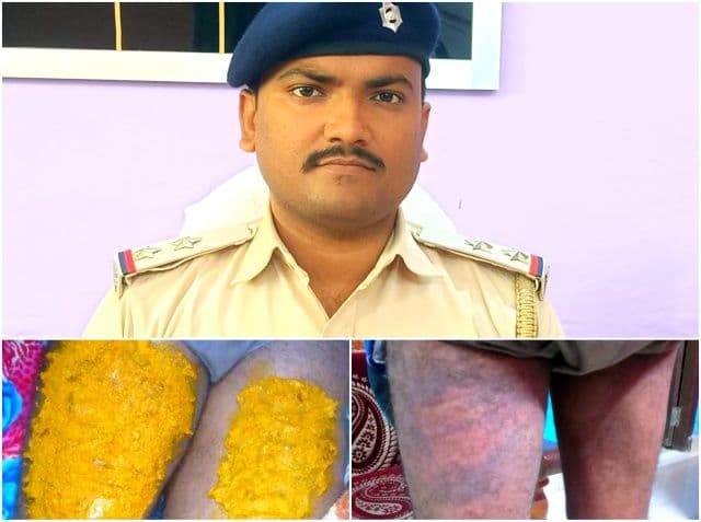 पुलिस हिरासत में क्रूरता पर हाईकोर्ट सख़्त, चैनपुर थाना प्रभारी निलंबित, तीन अधिकारी लाइन हाजिर